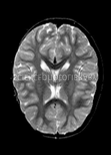 No Tumour VERIFIED