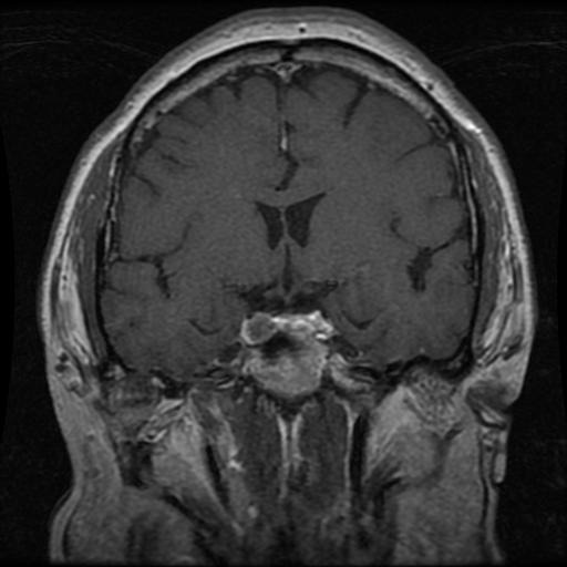 Pituitary LOW